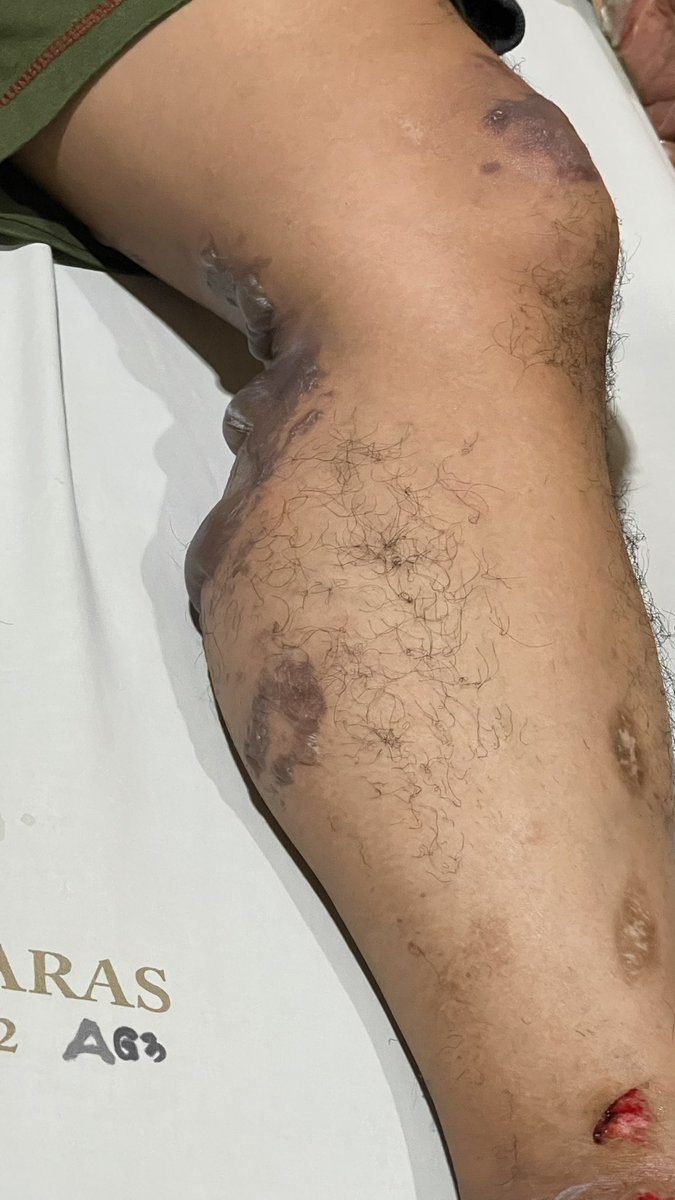 ulah pln sih ini makan korban genset meledak