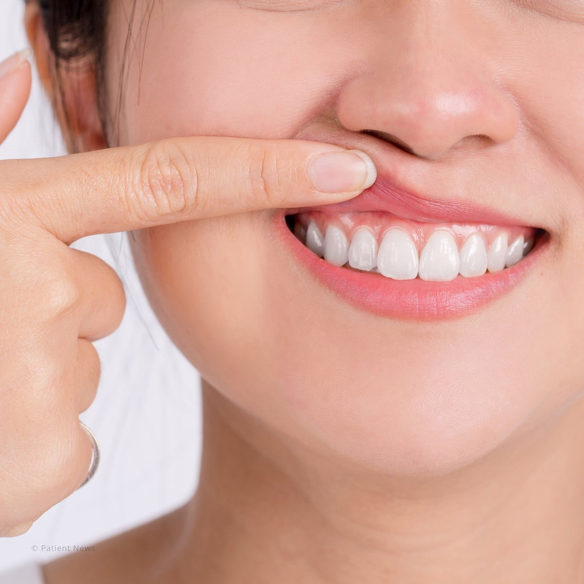 smile_quest_AB's tweet photo. Can you see a bit more of your teeth near your gums? You may be experiencing gum recession. Call us today &amp; we’ll help! #dentistry #teeth #smile #smilequestdental #familydentalservices #preventivecare #cosmeticservices #dentalservicesinstpaulalberta #stpauldentists https://t.co/Dn98o6rfQA