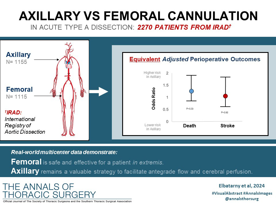 The Annals of Thoracic Surgery (@annalsthorsurg) on Twitter photo #EditorsChoice In this study, <a href="/MElbatarny/">Malak Elbatarny</a> et al compared the 2 dominant arterial cannulation strategies (axillary vs femoral) in a large international cohort of acute type A dissection repairs using more than 2 decades of experience. Read more 👇
doi.org/10.1016/j.atho… #EditorsChoice In this study, <a href="/MElbatarny/">Malak Elbatarny</a> et al compared the 2 dominant arterial cannulation strategies (axillary vs femoral) in a large international cohort of acute type A dissection repairs using more than 2 decades of experience. Read more 👇
doi.org/10.1016/j.atho…