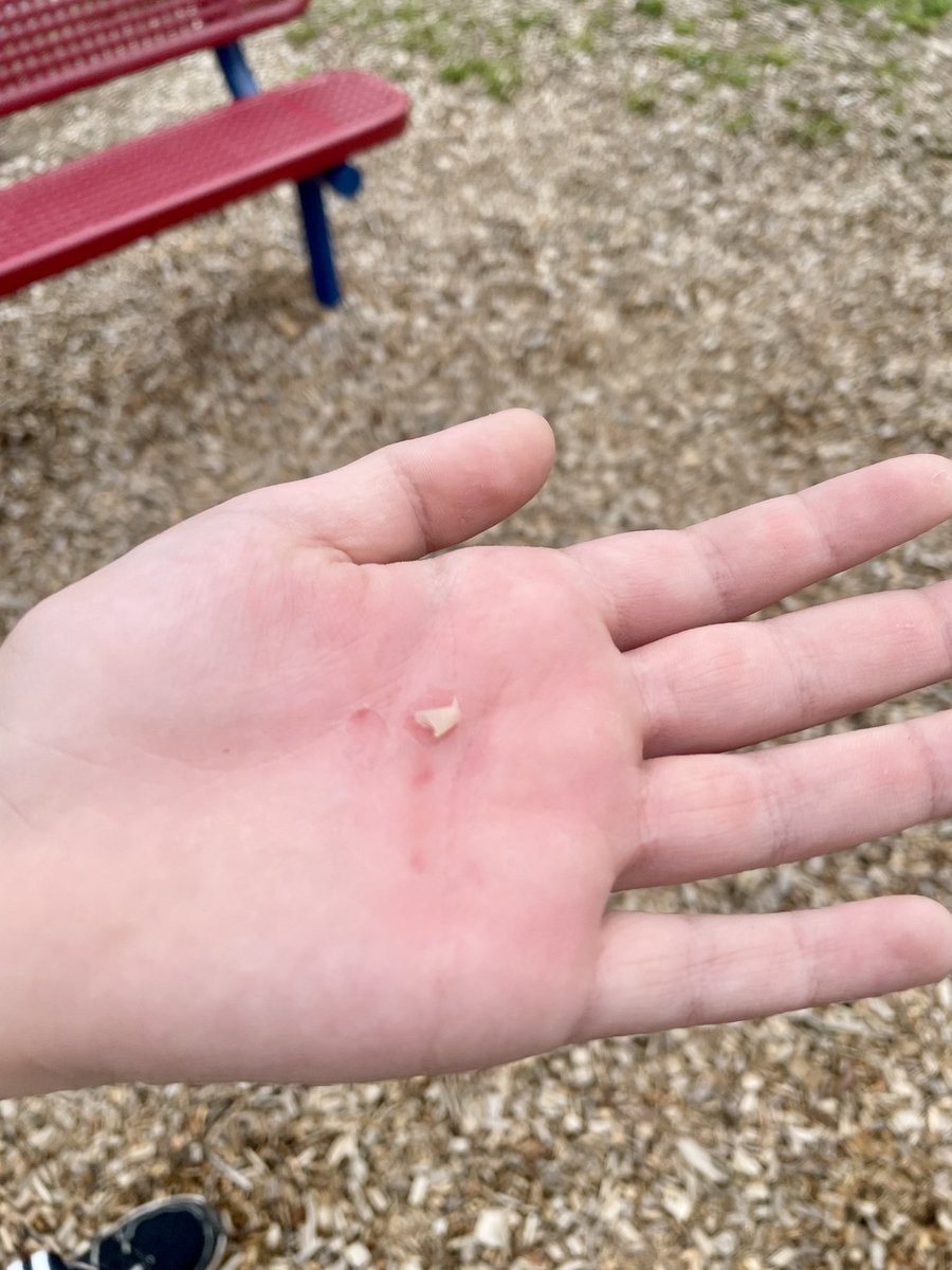 This ninja demonstrated amazing perseverance teaching himself a difficult skill today! #PhysEd