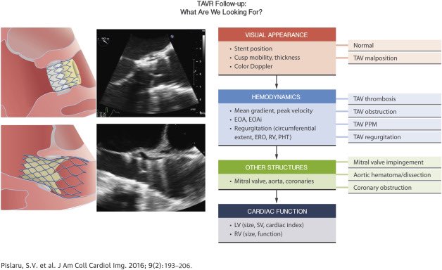 #NYValves2024 <a href="/crfheart/">Cardiovascular Research Foundation</a> <a href="/ASE360/">American Society of Echocardiography</a> #EchoFirst <a href="/hahn_rt/">RTHahnMD</a> <a href="/DeeDeeWangMD/">Dee Dee Wang MD</a> <a href="/gb_mackensen/">G. Burkhard Mackensen</a> 

Today is the imaging day

Important ✴️ to consider when discussing echo gradients for BEV vs SEV

BEV measured at the annular level 
SEV are supra-annular but the gradient is measured at the annulus
