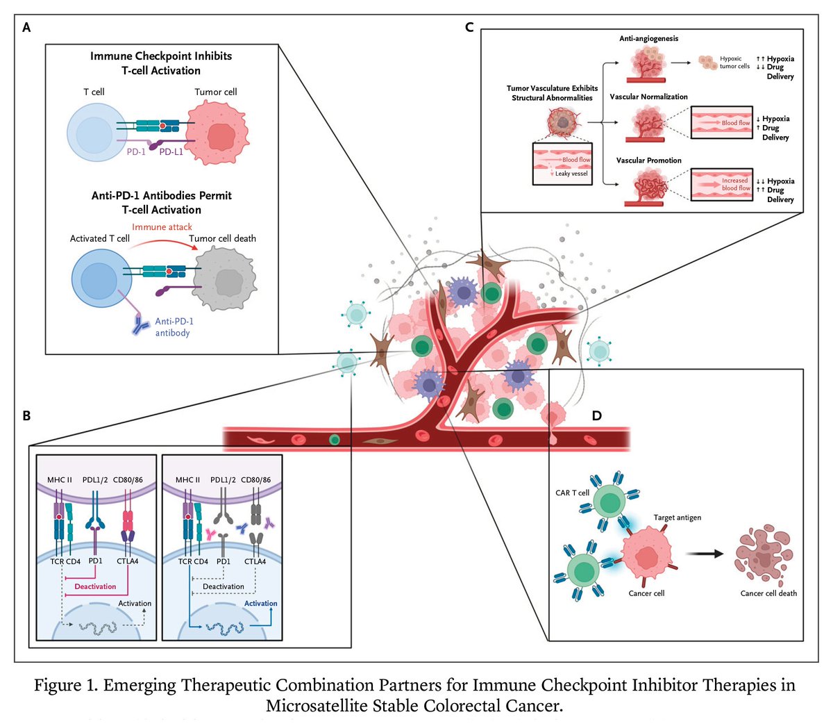 NEJM Evidence (@nejmevidence) on Twitter photo Subsets of patients with colorectal cancer respond to immune checkpoint inhibitors (ICI). Drs. <a href="/rprobinpark/">Robin Park, MD</a> and <a href="/AnwaarSaeed3/">Anwaar Saeed</a> review the literature on strategies to improve the response of colorectal cancer to ICI. 1/2 Subsets of patients with colorectal cancer respond to immune checkpoint inhibitors (ICI). Drs. <a href="/rprobinpark/">Robin Park, MD</a> and <a href="/AnwaarSaeed3/">Anwaar Saeed</a> review the literature on strategies to improve the response of colorectal cancer to ICI. 1/2