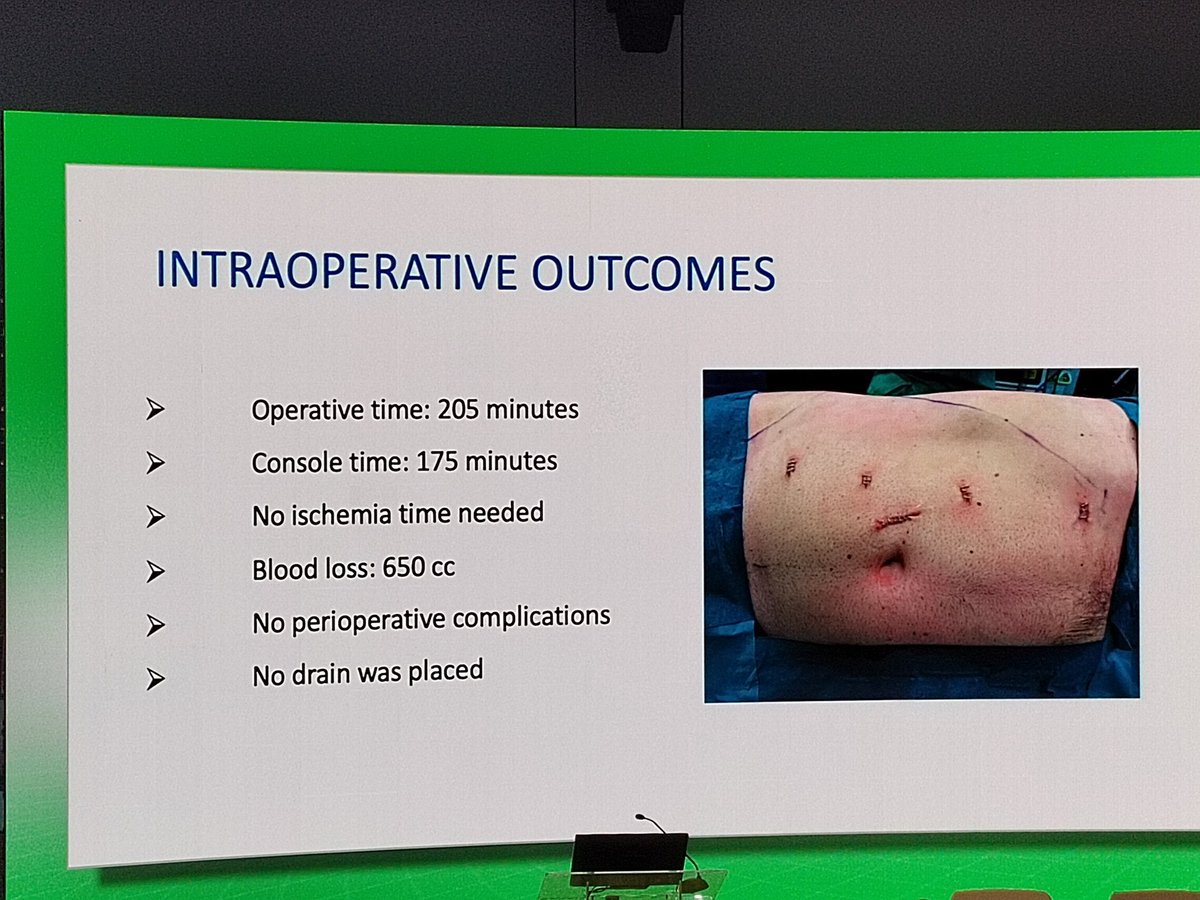 Abdalla Deb (@abdalladeb) on Twitter photo Sutureless Clampless RAPN by <a href="/alexmottrie/">Alex Mottrie</a> at @CILR2024 on the very busy Kidney Ca day - presented by my friend <a href="/FregoNicola/">Nicola frego</a> from <a href="/orsiacademy/">Orsi Academy</a> Sutureless Clampless RAPN by <a href="/alexmottrie/">Alex Mottrie</a> at @CILR2024 on the very busy Kidney Ca day - presented by my friend <a href="/FregoNicola/">Nicola frego</a> from <a href="/orsiacademy/">Orsi Academy</a>
