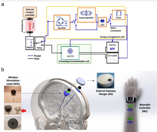 UofL Neurosurgery (@uoflneurosurg) on Twitter photo An exciting new technology that could be used in future DBS surgeries! Congrats Dr. Joseph Neimat on the publication of your article on A Novel Closed-Loop Electrical Brain Stimulation Device in <a href="/JNeuromod/">Neuromodulation Journal</a>.
authors.elsevier.com/a/1jB4y3uwDfnw…
#UofLNeurosurgery #Neurosurgery <a href="/UofLHealth/">UofL Health</a> @UofL An exciting new technology that could be used in future DBS surgeries! Congrats Dr. Joseph Neimat on the publication of your article on A Novel Closed-Loop Electrical Brain Stimulation Device in <a href="/JNeuromod/">Neuromodulation Journal</a>.
authors.elsevier.com/a/1jB4y3uwDfnw…
#UofLNeurosurgery #Neurosurgery <a href="/UofLHealth/">UofL Health</a> @UofL