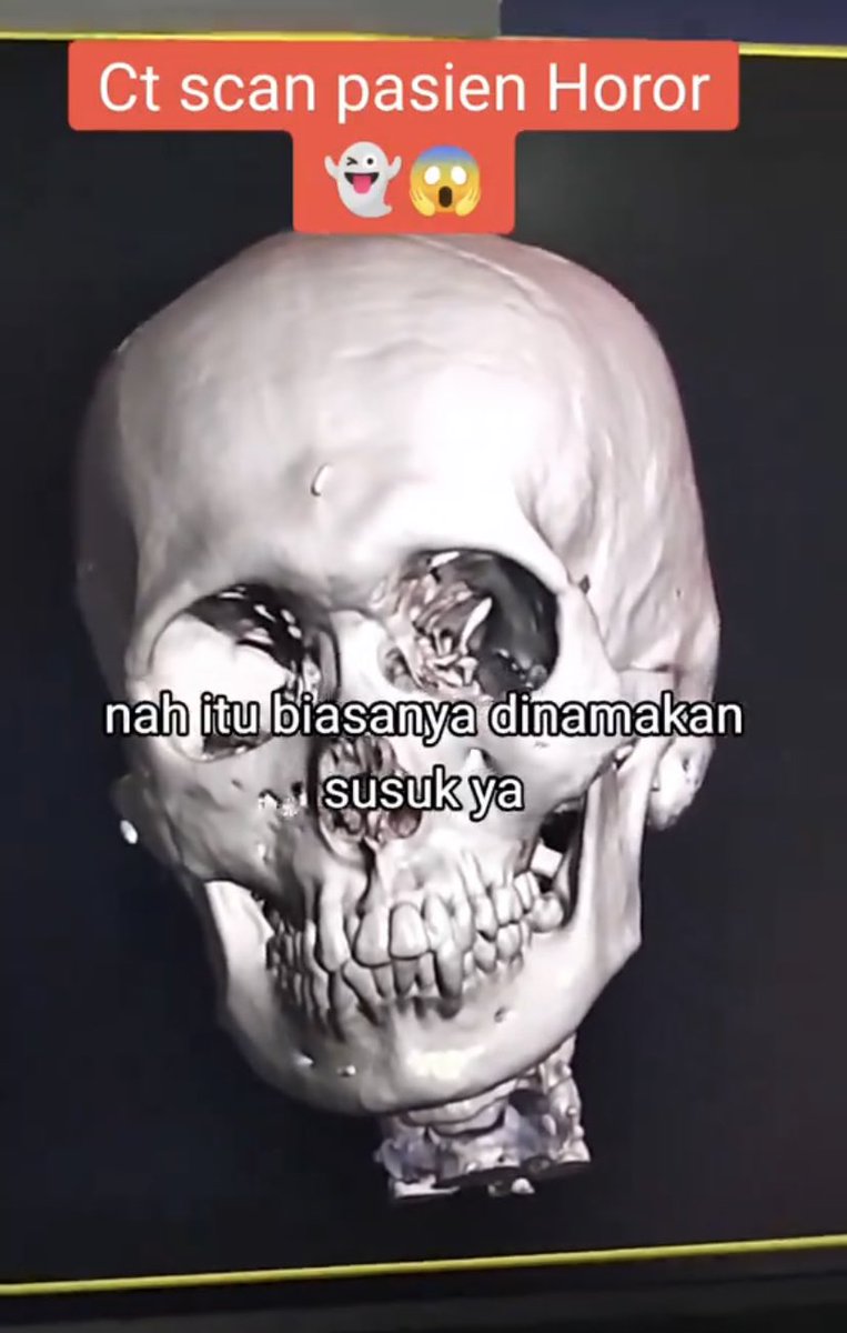 ternyata memang ada kirain cuma mitos

— a thread