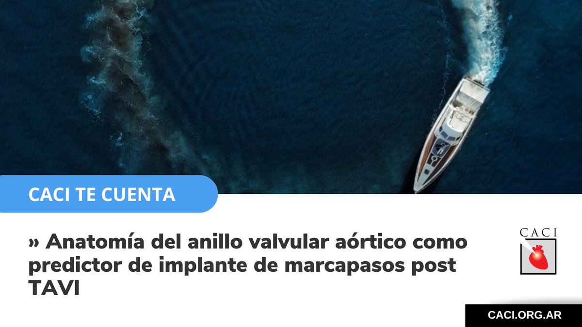 CACIarg's tweet photo. Anatomía del anillo valvular aórtico como predictor de implante de marcapasos post TAVI, por el Dr. @CMGarmendia

🔗 Léalo en https://t.co/7WKDKMViAl

#TAVI #TAVR #annulus #PPI #marcapasos #AnilloAórtico #balloon #pacemaker #bloqueo #RBBB #calcium #valve #risk #prediction https://t.co/SBsCVgaoTO