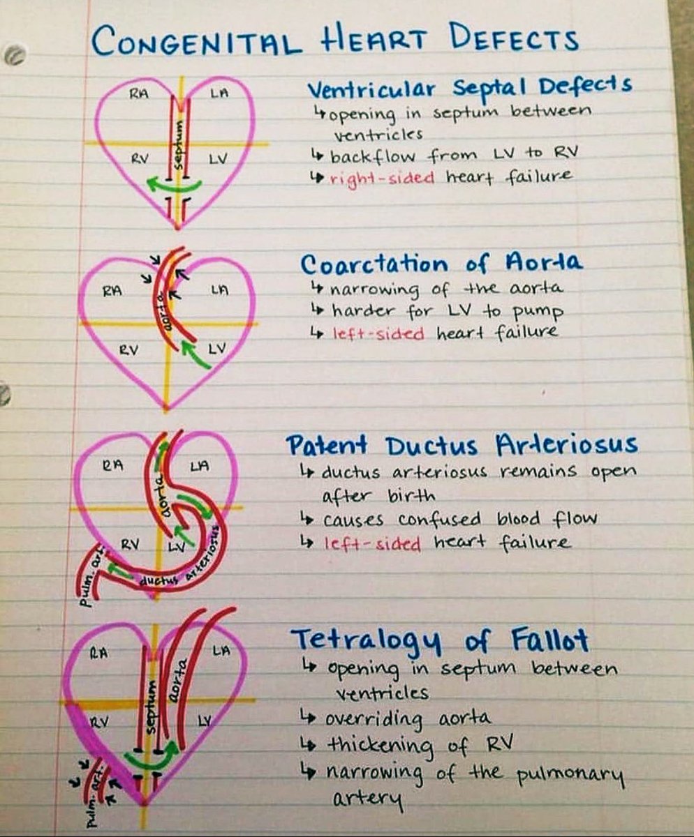 Doctors__squad's tweet photo. Congenital heart defects. https://t.co/HPo4kDporf