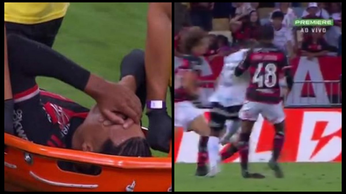 O Flamengo informa: 

"Everton Cebolinha sentiu dores no músculo anterior da coxa direita.

Igor Jesus sofreu uma entorse no tornozelo esquerdo.

Ambos iniciaram tratamento no vestiário."