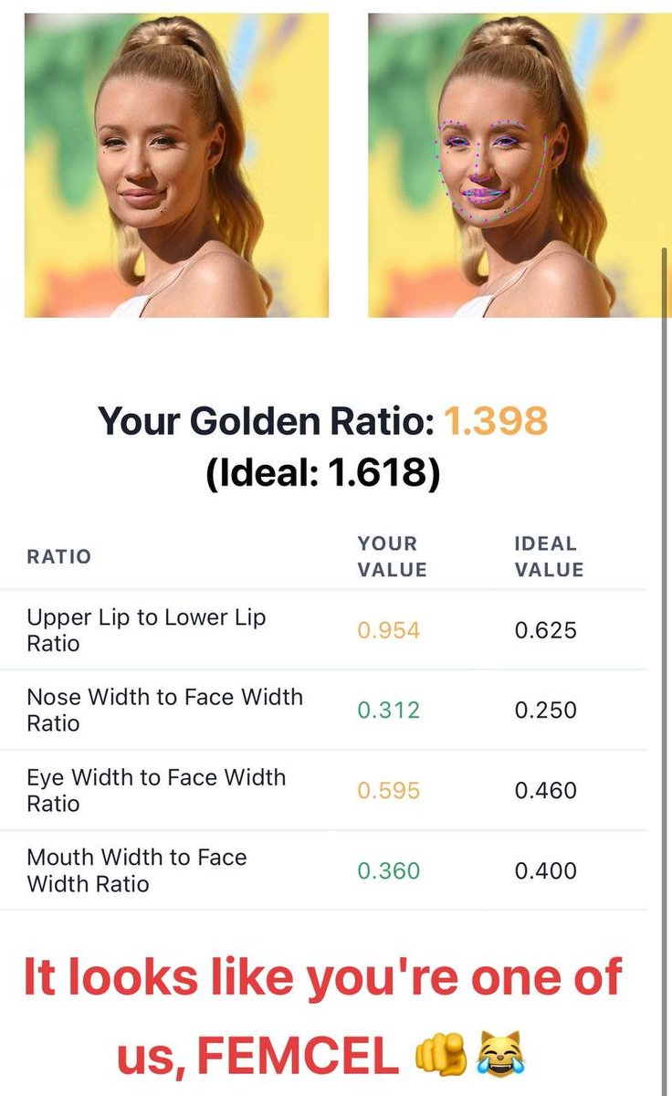 <a href="/Iggyazalea/">IGGY AZALEA</a> blocked me because she's a $femcel.