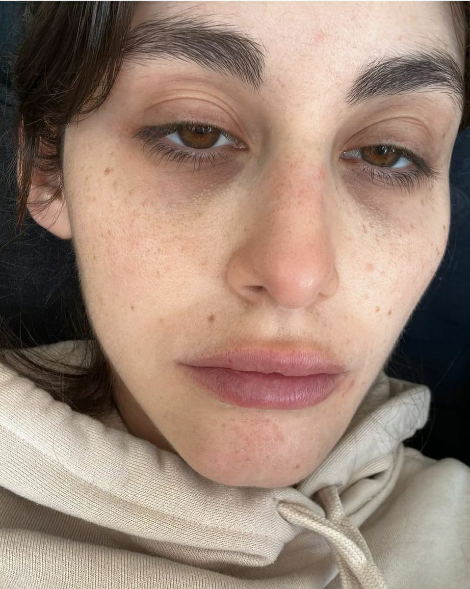 Celebs__Arabic's tweet photo. الجميلة نور عريضة تشارك صورتها من دون مكياج تحت عنوان "حبي حالك" 🥰❤️. https://t.co/HxczgxqQ7Y