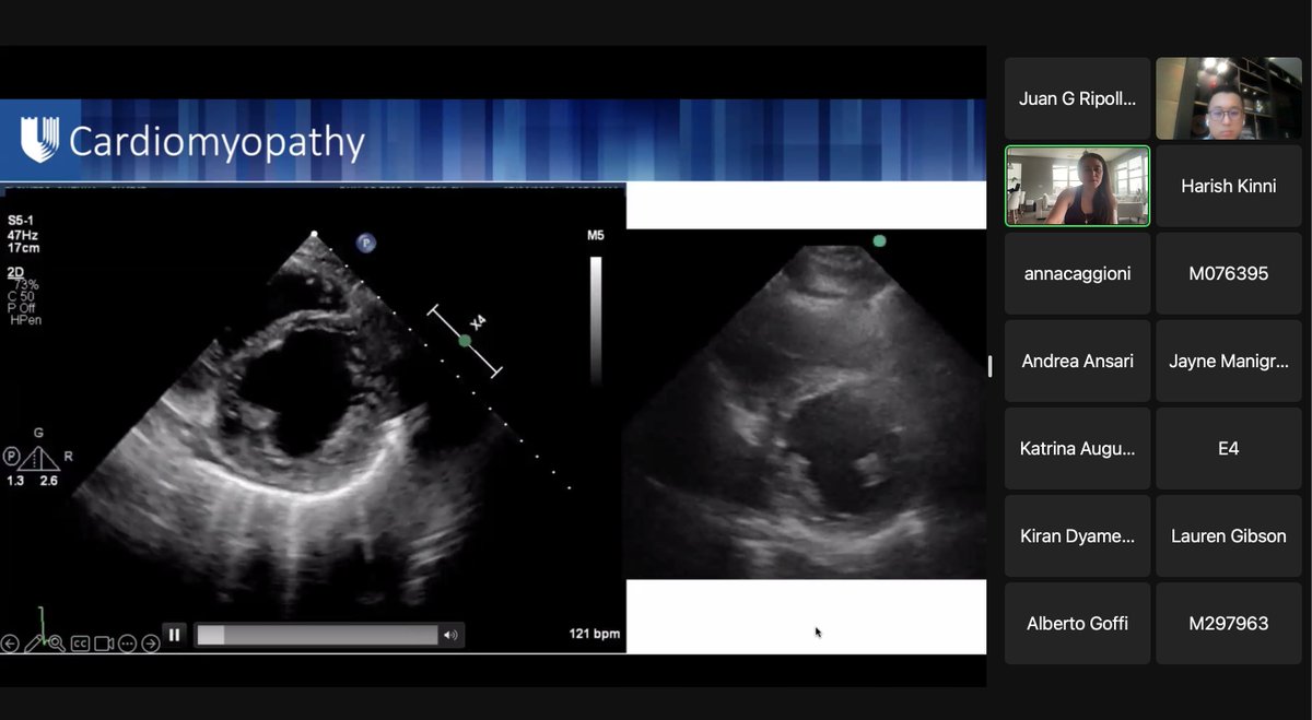 TenzingMD's tweet photo. An excellent primer on how to manage parturient pts with cardiomyopathy using echo by @Duke_Anesthesia  expert @maloumeng for the MGH-Mayo Critical Care Echo Consortium lecture series! #Echofirst #POCUS #CardioObstetrics #ObAnes https://t.co/JIJzWijMaB