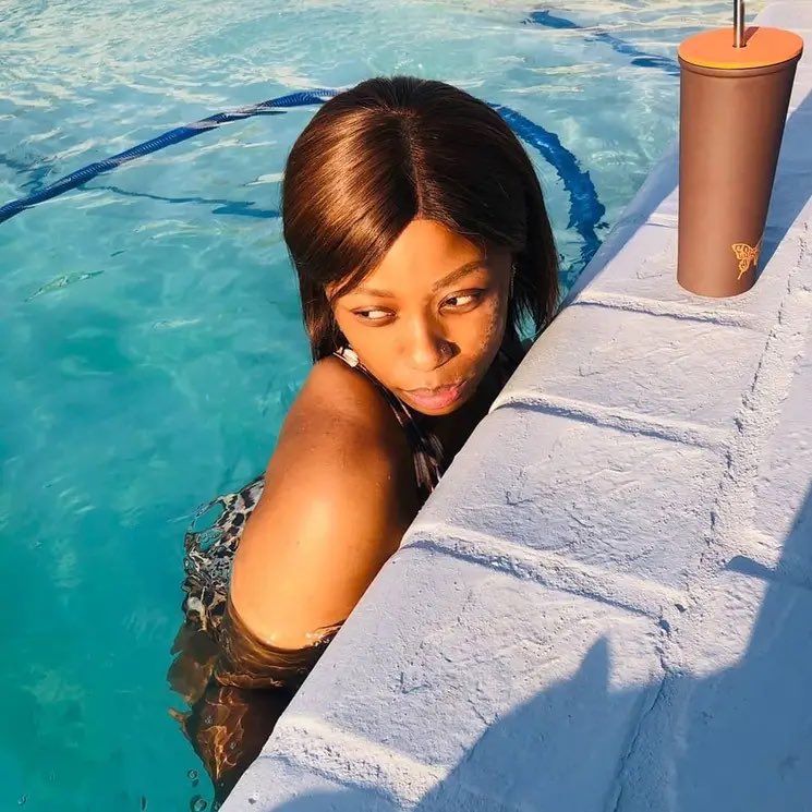 Katli_Atile's tweet photo. Am I the only one missing SUMMER 🥹😩

#Origin #skin #Art #vitiligo #SA #fypシviralシfyp #MK #heating https://t.co/5Az08uA6wW