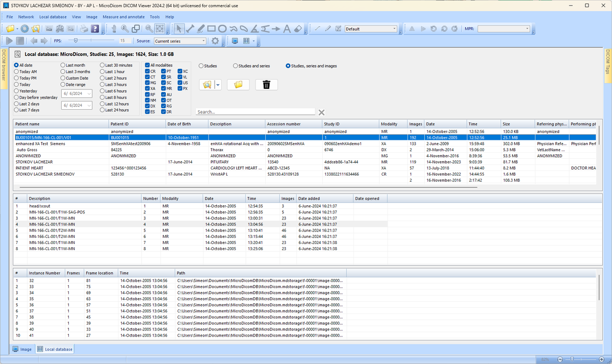 microdicom's tweet photo. The latest version MicroDicom 2024.2 introduced Local database and many new feature and improvements. https://t.co/sBndrcXBZ7