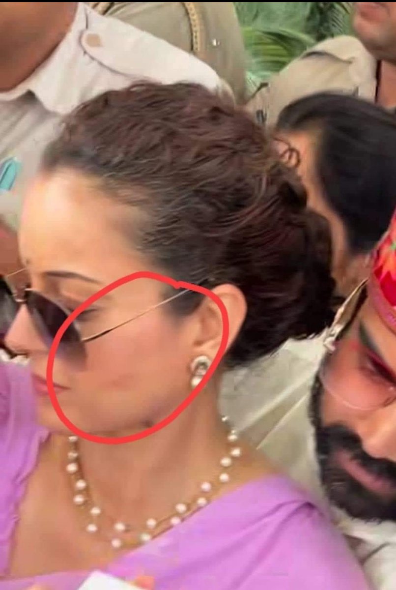 मै ये नहीं समझ पा रहा हूं कि बात तो खटाखट-खटाखट की हुई थी ये बीच में चटाचट-चटाचट क्यूं शुरू हो गई ? 

कँगना देश की पहली महिला भाजपा सांसद बनी जिन्हें शपथ ग्रहण से पहले सर्टिफिकेट और विभाग मिला।