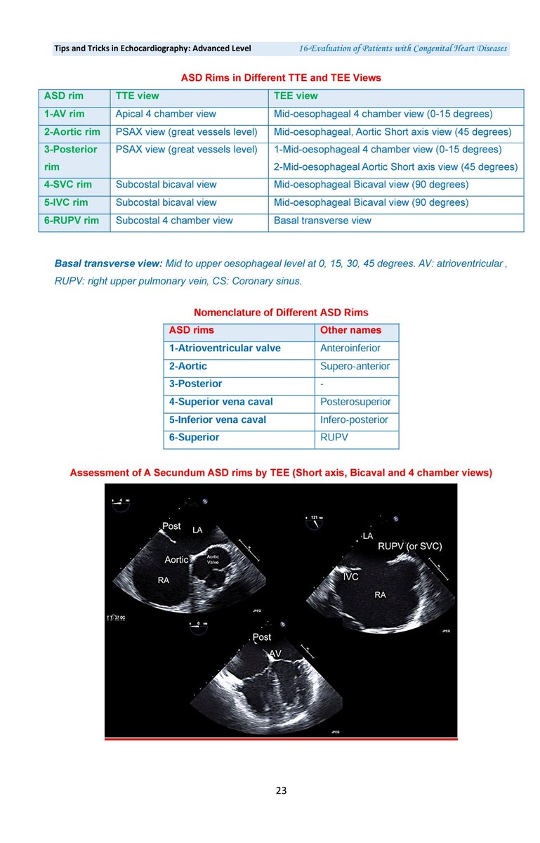 drahmedmohsen85's tweet photo. If you are a professional Echocardiographer, it is very important that you know the Different rims of ASD and where each one is, whether TTE or TEE. Check out this beautiful collection from my recent book" Tips &amp;Tricks in Echo -Advanced level". https://t.co/B8H9UEKRUW