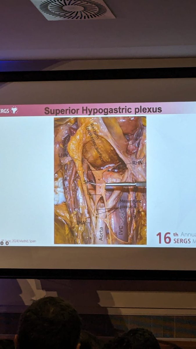 sergi_fg's tweet photo. @SERGS_org congress has taken off today with:
-Bening gyn robotic live surgery 🦾
-Fascinating lectures 🤓
-Coñlaboration among societies ✨
-And live music from “la Tuna”🪕
Anything else? And tomorrow more!!!
🙌🏻🙌🏻🙌🏻🦾🦾🦾 https://t.co/Jl5RtvRs16