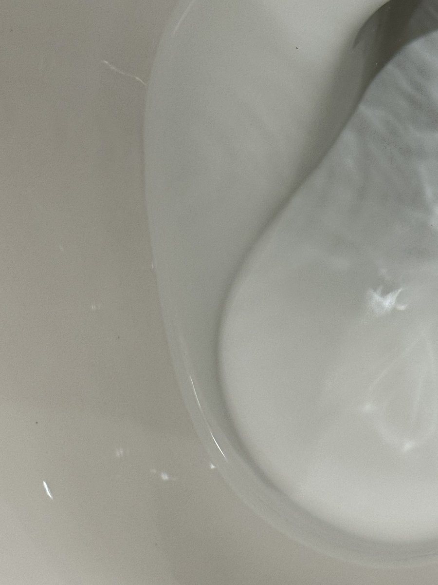 scrum03906's tweet photo. 先日は、トイレの尿石や黒ずみと戦っておりました。市販の洗剤・薬剤でなかなか落ちず、耐水性の目が2000くらい細かい紙やすりでフチの尿石を物理的に削りました。
トイレ掃除もこまめにお願いします。流石に、汚れているトイレはア��プしません。
#賃貸　#賃貸の豆知識　#ユーミーマンション　#お掃除 https://t.co/pGg2pP8Gvt