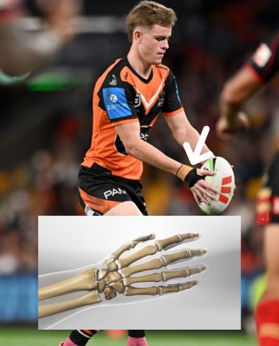 NRL PHYSIO tweet media