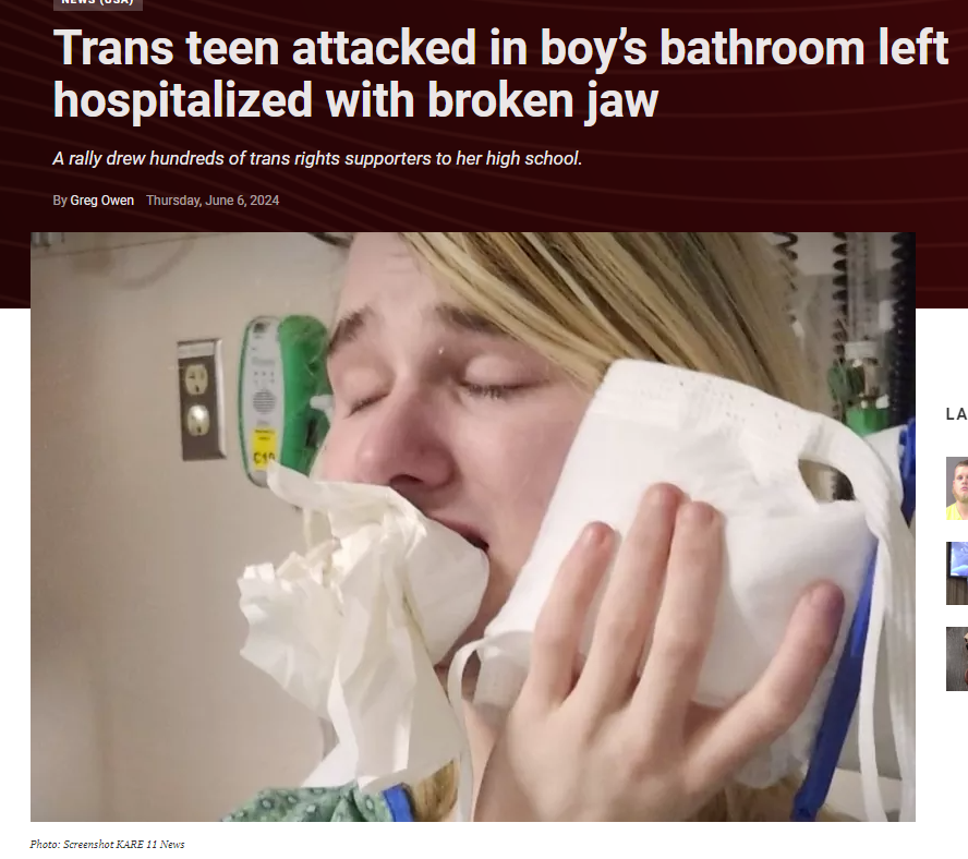 There is a lot of fear spread about trans people in bathrooms, without acknowledging that transgender people are the most likely to be assaulted in bathrooms, by cisgender people.

This trans girl even used the bathroom anti-trans folks wanted her to.

And she got beaten for it.