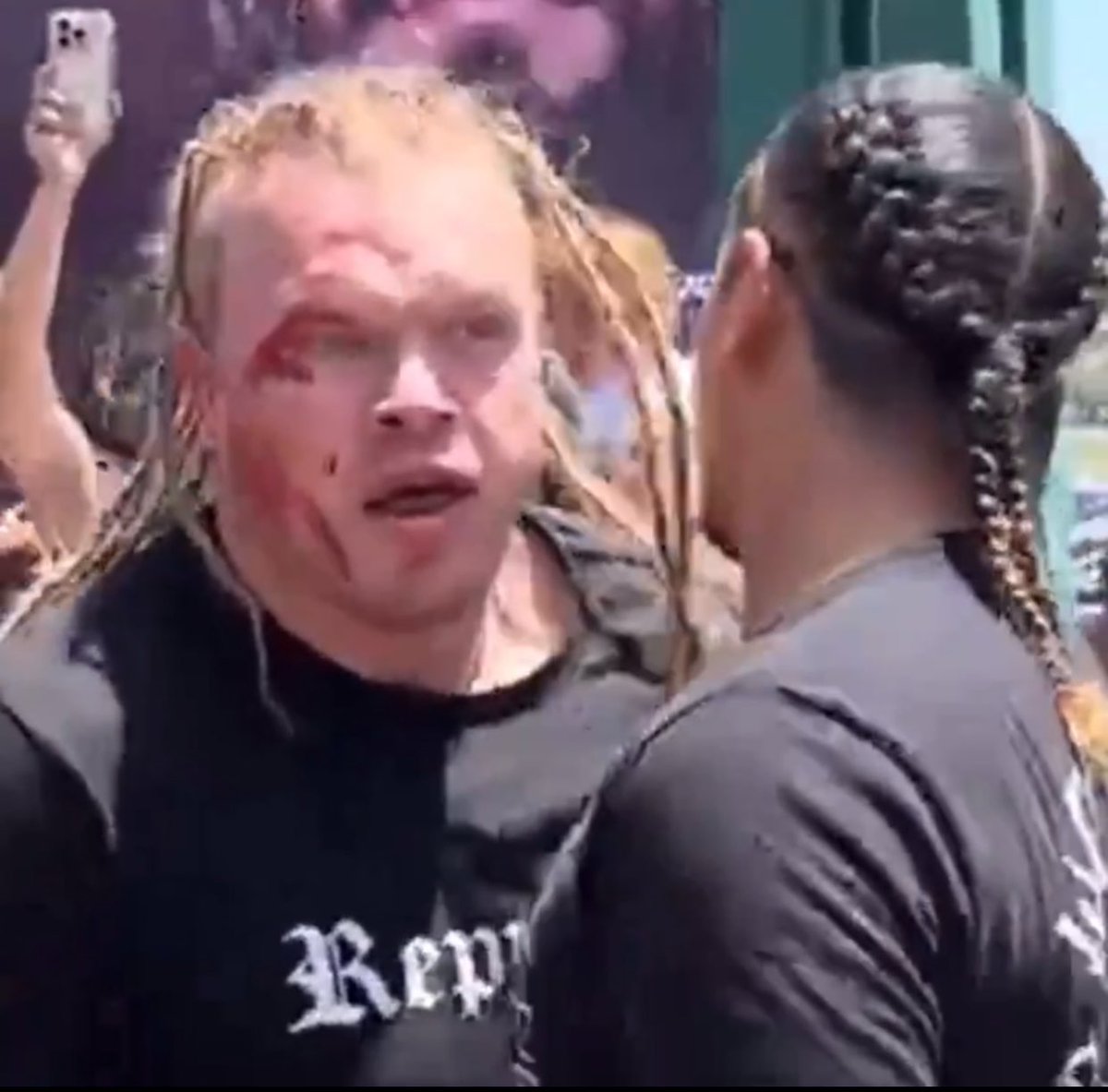 Combat_Casuals's tweet image. The dude that threw the first punch in the Diaz/Masvidal team brawl got MESSED UP😳‼️

Jorge was holding onto his hair the whole time😂

#MMA