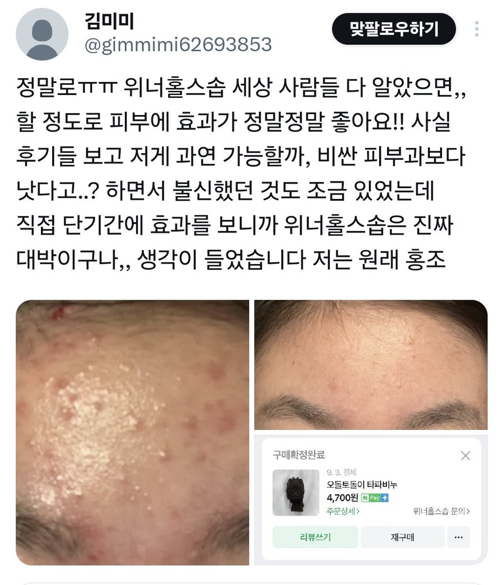 manduuiilsang's tweet photo. 피부 좋아지실 수 있도록 언제나 노력합니다!
타파앰플+타파비누+스팟크림 이 조합을
알티추첨 3분 보내드리겠습니다
일주일만 써보시면 피부가 그냥 달라요

알티만 해쥬심 됩니당
택배비도 제부담!! https://t.co/awfOed6Cux
