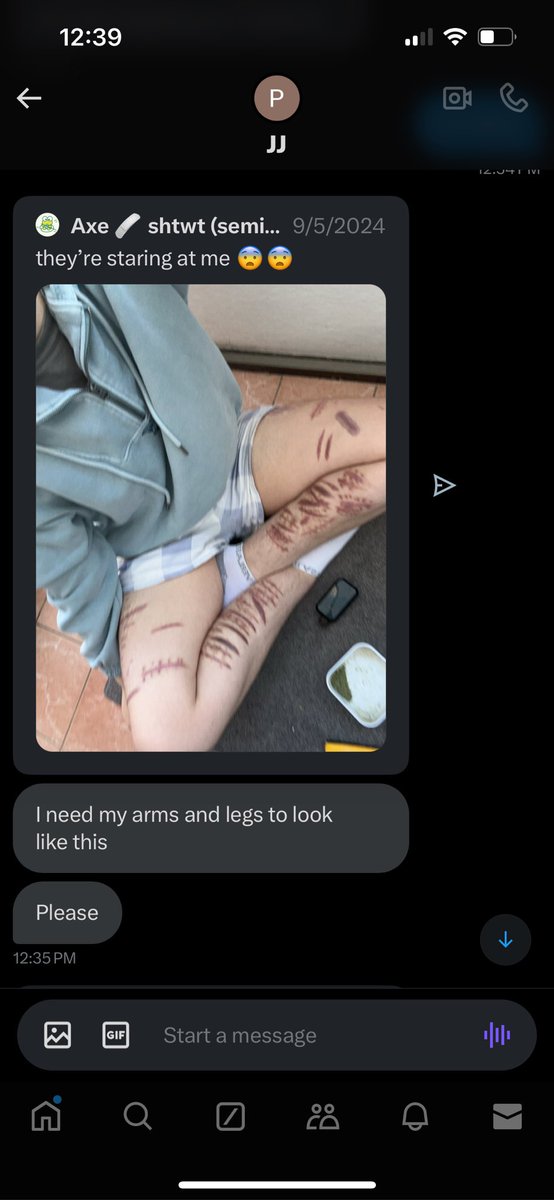 Axe 🩹 shtwt (recovery) tweet media