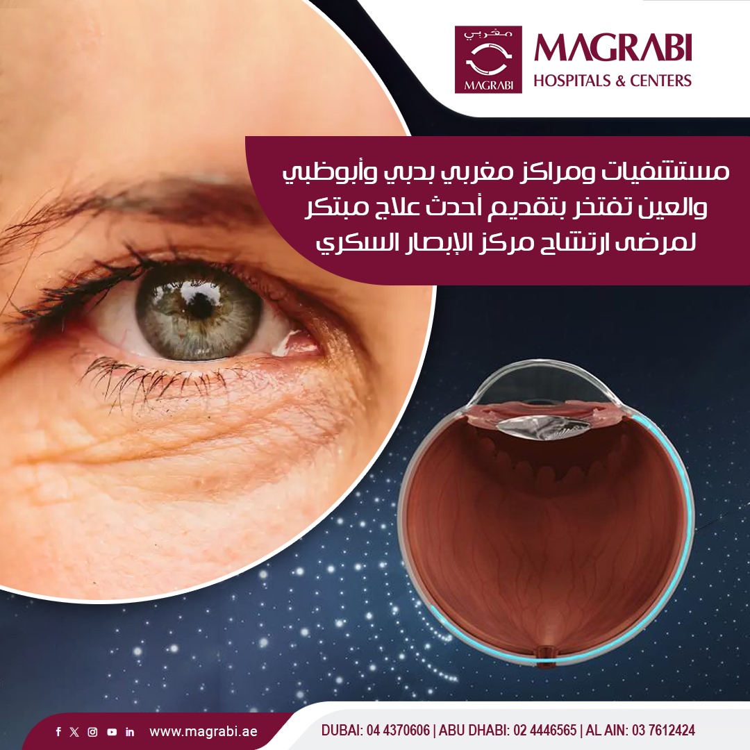 مستشفيات ومراكز مغربي بدبي وأبوظبي والعين تفتخر بتقديم أحدث علاج مبتكر لمرضى ارتشاح مركز الإبصار السكري

رؤية واضحة تنتظرك في مستشفيات ومراكز مغربي - الخبراء في طب وجراحة العيون

☎ لتحديد موعد:
أبوظبي: 4446565-02
دبي: 4370606-04
العين: 03-7612424

#eyehealth #healthyvision