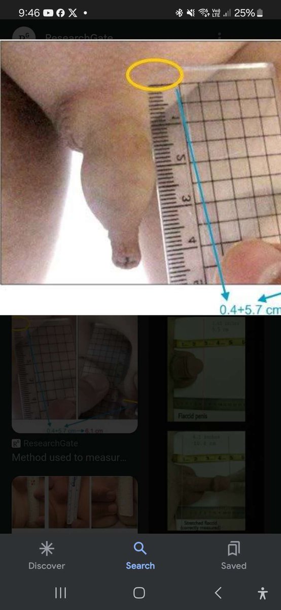 Angus1322131's tweet photo. To the post I just did I hope your uncircumcised  looks like this afterwards https://t.co/r4lCJVQ5mU