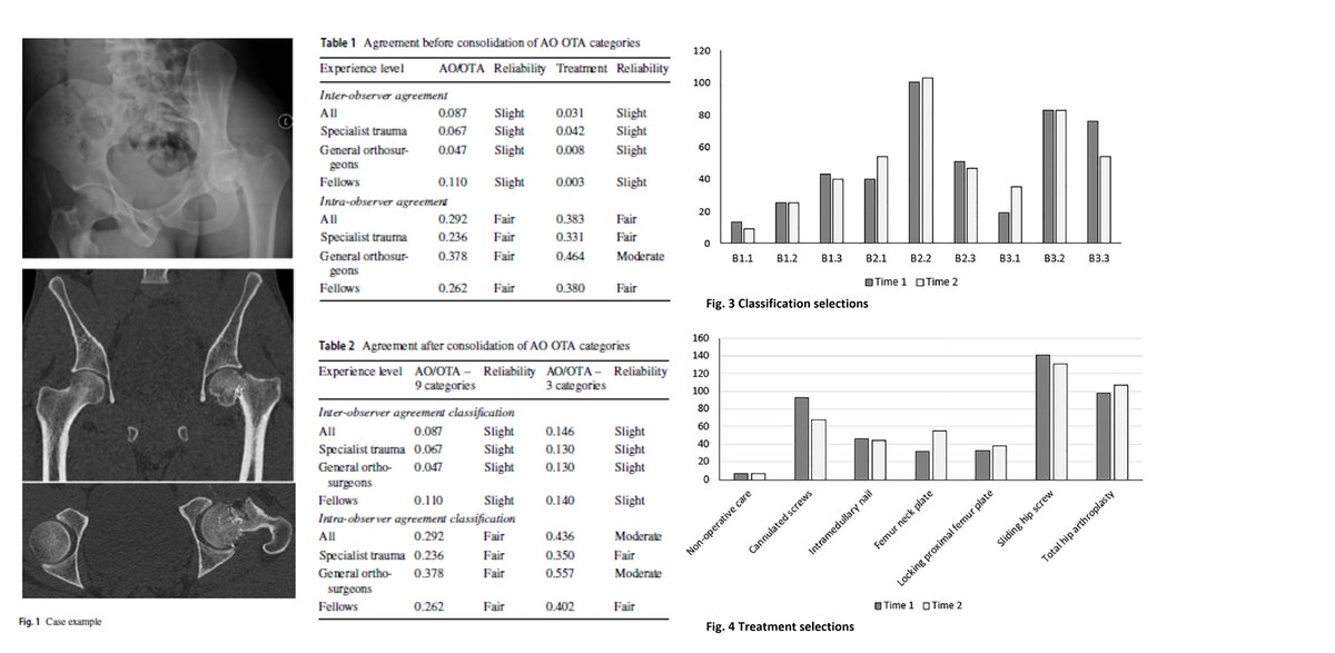 Femur neck #gunshot #fractures: Slight inter‑&amp; intra‑observer reliability using AO/OTA classification &amp; failure to guide #surgical #treatment. Is its routine use in daily clinical practice of value? 📋link.springer.com/article/10.100…
<a href="/EJOST_/">European Journal of Ortho Surgery and Traumatology</a>  <a href="/MaritzLaubscher/">Maritz Laubscher</a> <a href="/DrSiGraham/">Simon Graham</a> <a href="/traumacentre1/">Andrew Nicol</a>