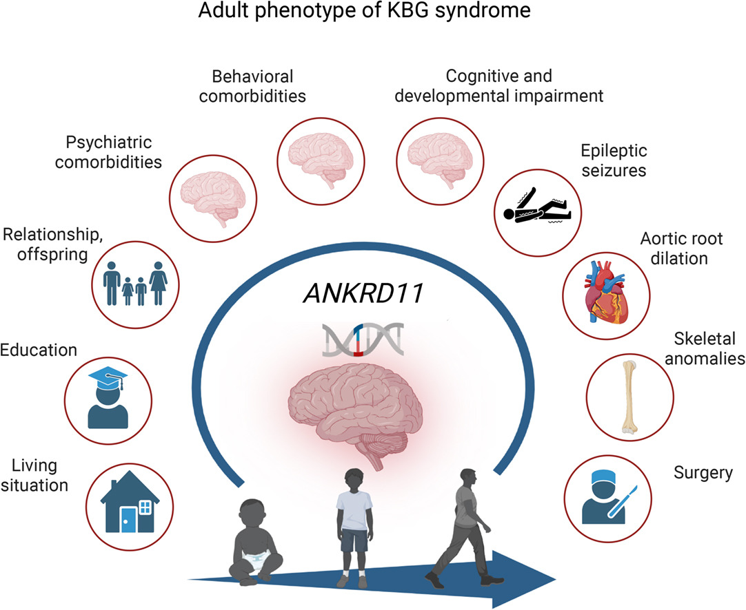 hug_leipzig's tweet photo. ๐study sheds light on the long-term neurodevelopmental outcomes, seizures, behavioral and psychiatric features, and education, work, and living arrangements for adults with #KBGS (a rare syndrome caused by haploinsufficiency of #ANKRD11) โ read more: https://t.co/2lE08W5ty6 https://t.co/jWRhyLSDN6