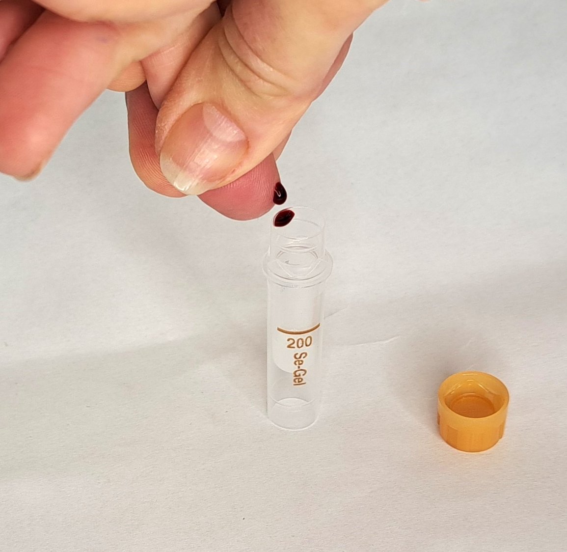 T1DRAdiabetes's tweet photo. Need something to do this weekend? How about signing up for T1DRA (https://t.co/yXWcxhW4Ty), to find out more about your risk of developing Type 1 diabetes &amp; to contribute towards vital research. All it takes is a simple at home finger prick sample https://t.co/J5Hyv1gTfB