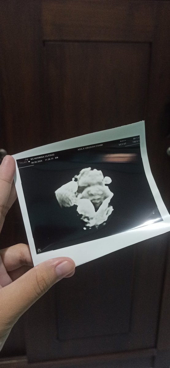 Adiladia's tweet photo. Sehat2 ya dedek, semoga bisa lahir tepat waktu sesuai usia dedek.. Beberapa hari ini kita istirahat dulu❤ https://t.co/UF0V0qc0QW