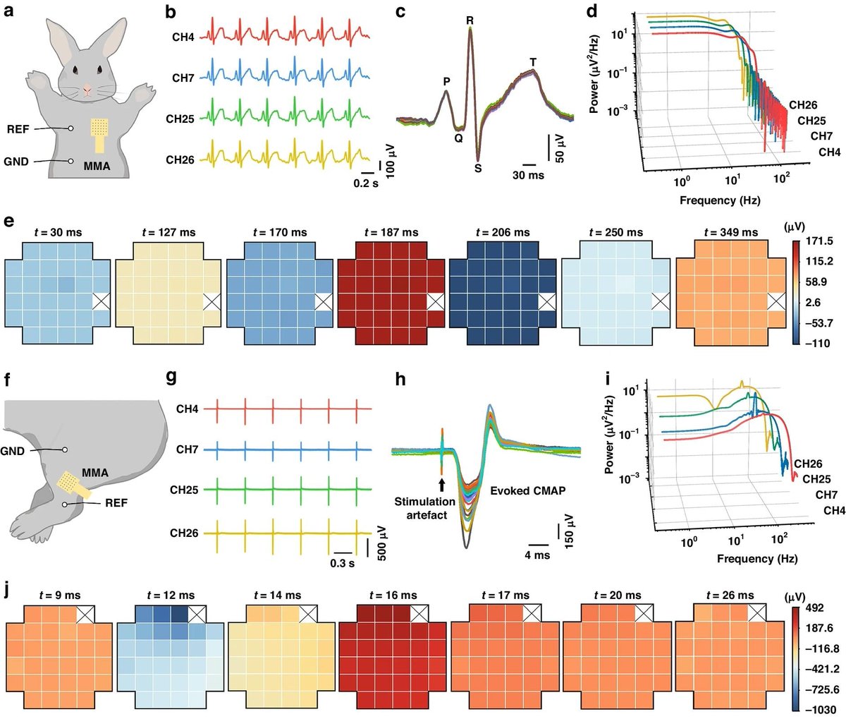 AZoSensors's tweet image. Microneedle Patches Boost Electrophysiology Accuracy 

🔗azosensors.com/news.aspx?News…

@MicrosysNanoeng #microneedle #electrophysiology #accuracy #sensors #research