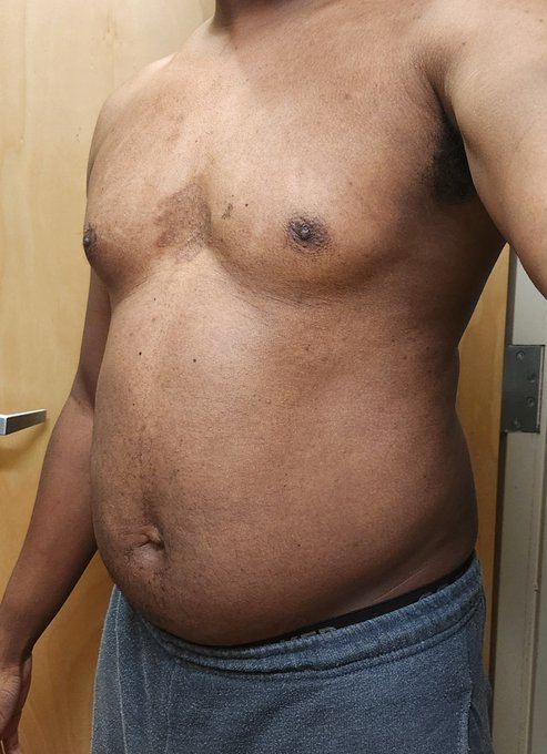 Got the pictures but forgot to post Day six. This is about the be the first time I've inflated for a