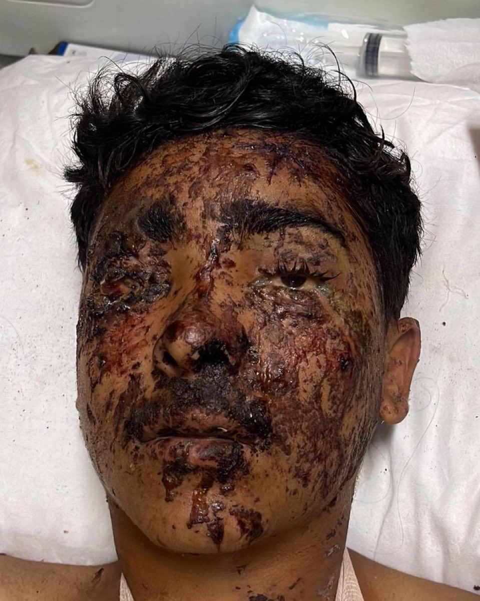 لا اعتذر لقساوة المشهد ويجب ان يشاهده كل العالم