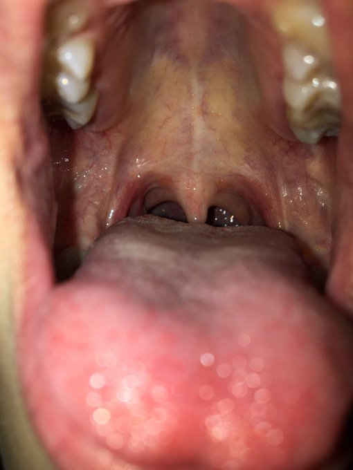 Did you miss my pink uvula? #uvula #fetish #mouthfetish https://t.co/EbjKmvDm3t<a href="/tag/uvula"class="tags">#uvula</a><a href="/tag/fetish"class="tags">#fetish</a><a href="/tag/mouthfetish"class="tags">#mouthfetish</a>