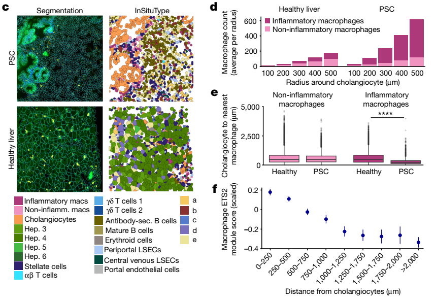 James Lee (@dr_james_lee) on Twitter photo Not just IBD though - similar changes were found in #PSC (a liver disease) for which there are no treatments currently. Kudos to the amazing teams @nanostringtech and <a href="/nigeljamieson/">Nigel B. Jamieson</a> lab in Glasgow for help with this Not just IBD though - similar changes were found in #PSC (a liver disease) for which there are no treatments currently. Kudos to the amazing teams @nanostringtech and <a href="/nigeljamieson/">Nigel B. Jamieson</a> lab in Glasgow for help with this