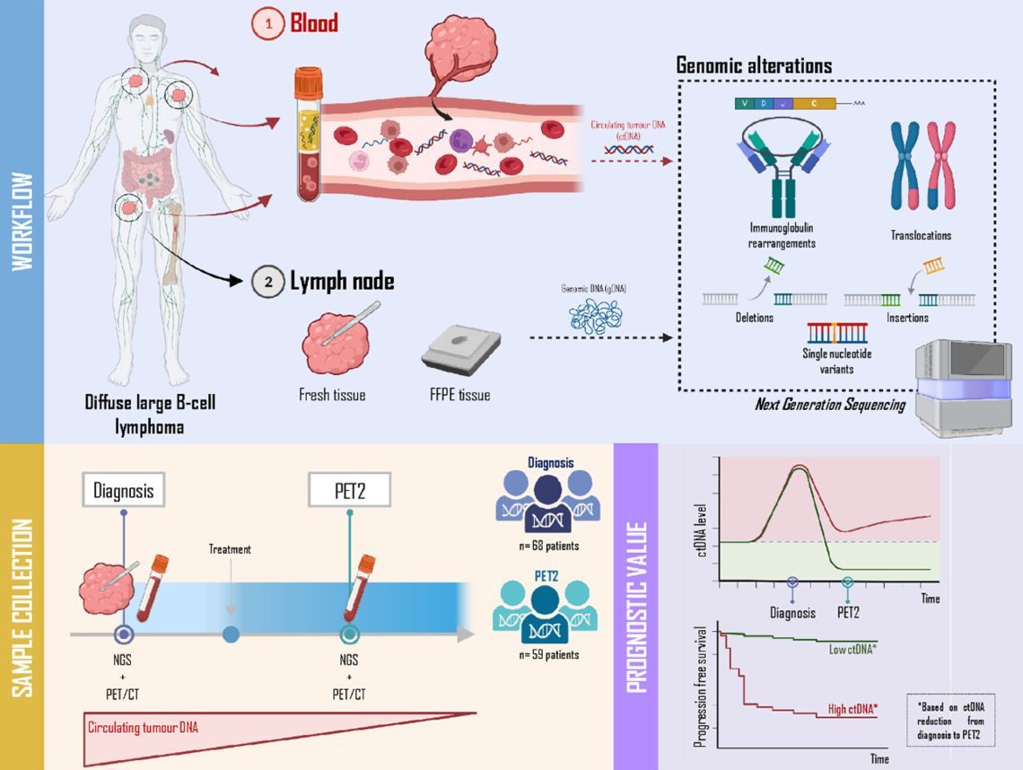 BrJHaem's tweet photo. Liquid biopsy for molecular characterization of diffuse large B-cell lymphoma and early assessment of minimal residual disease 
https://t.co/12VuWEQ3R0 https://t.co/cnKkpWjSm9