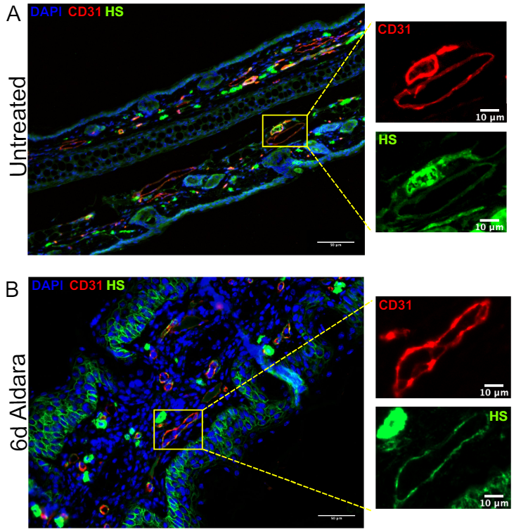 Waggoner Lab (@labwaggoner) on Twitter photo Leukocytes express heparan sulfate glycocalyx on their cell surface that regulates recruitment and which is lost in response to psoriasis-like skin inflammation <a href="/douglaspdyer/">Douglas Dyer</a> <a href="/MegTriesScience/">Megan Priestley</a> <a href="/SaundersLab1/">The Saunders Lab</a>
doi.org/10.1101/2024.0… Leukocytes express heparan sulfate glycocalyx on their cell surface that regulates recruitment and which is lost in response to psoriasis-like skin inflammation <a href="/douglaspdyer/">Douglas Dyer</a> <a href="/MegTriesScience/">Megan Priestley</a> <a href="/SaundersLab1/">The Saunders Lab</a>
doi.org/10.1101/2024.0…