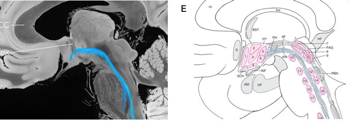 The supplementary material of this study is a hidden gem for anyone interested in neuroanatomy of subcortical tracts! 

This should be a textbook.
nature.com/articles/s4146…
static-content.springer.com/esm/art%3A10.1…