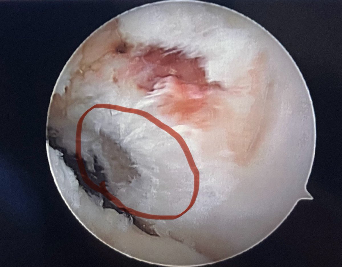 Clayton Nuelle, MD, FAAOS tweet media