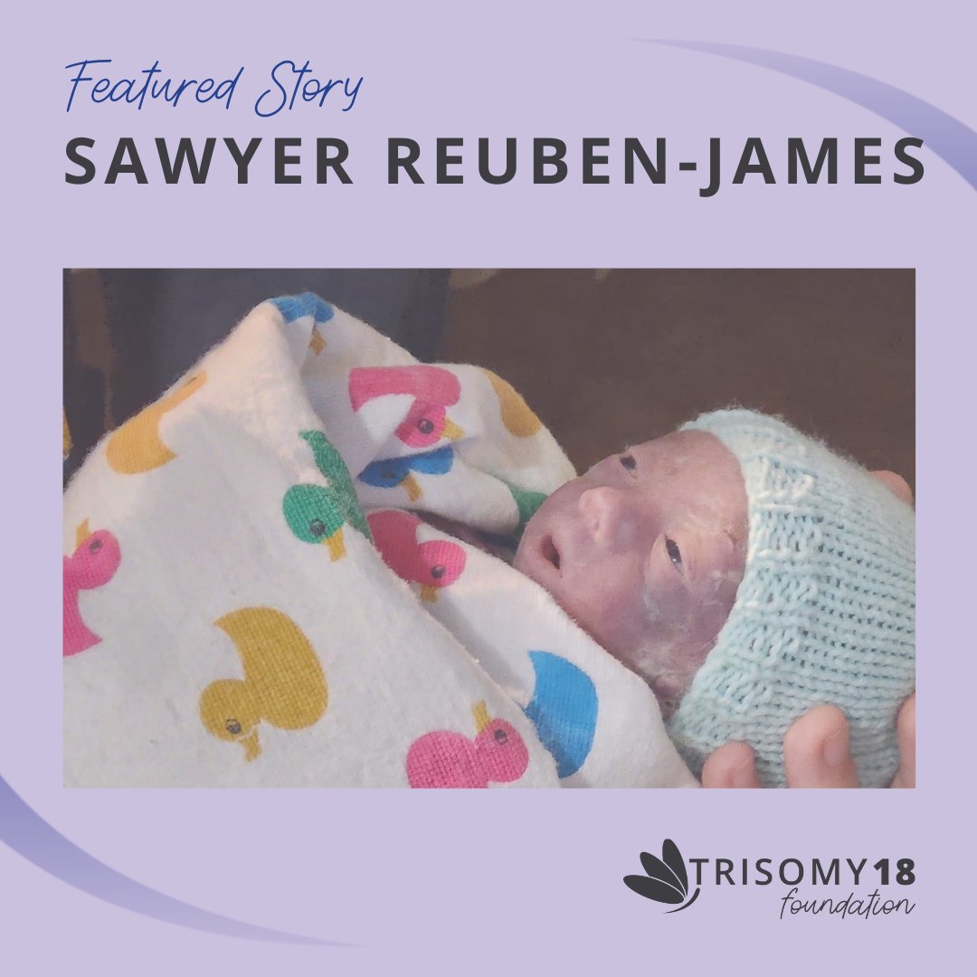 A mother shares how "making decisions from a place of love is one of the hardest but most beautiful things a parent can do."

trisomy18.org/story/sawyer-r…