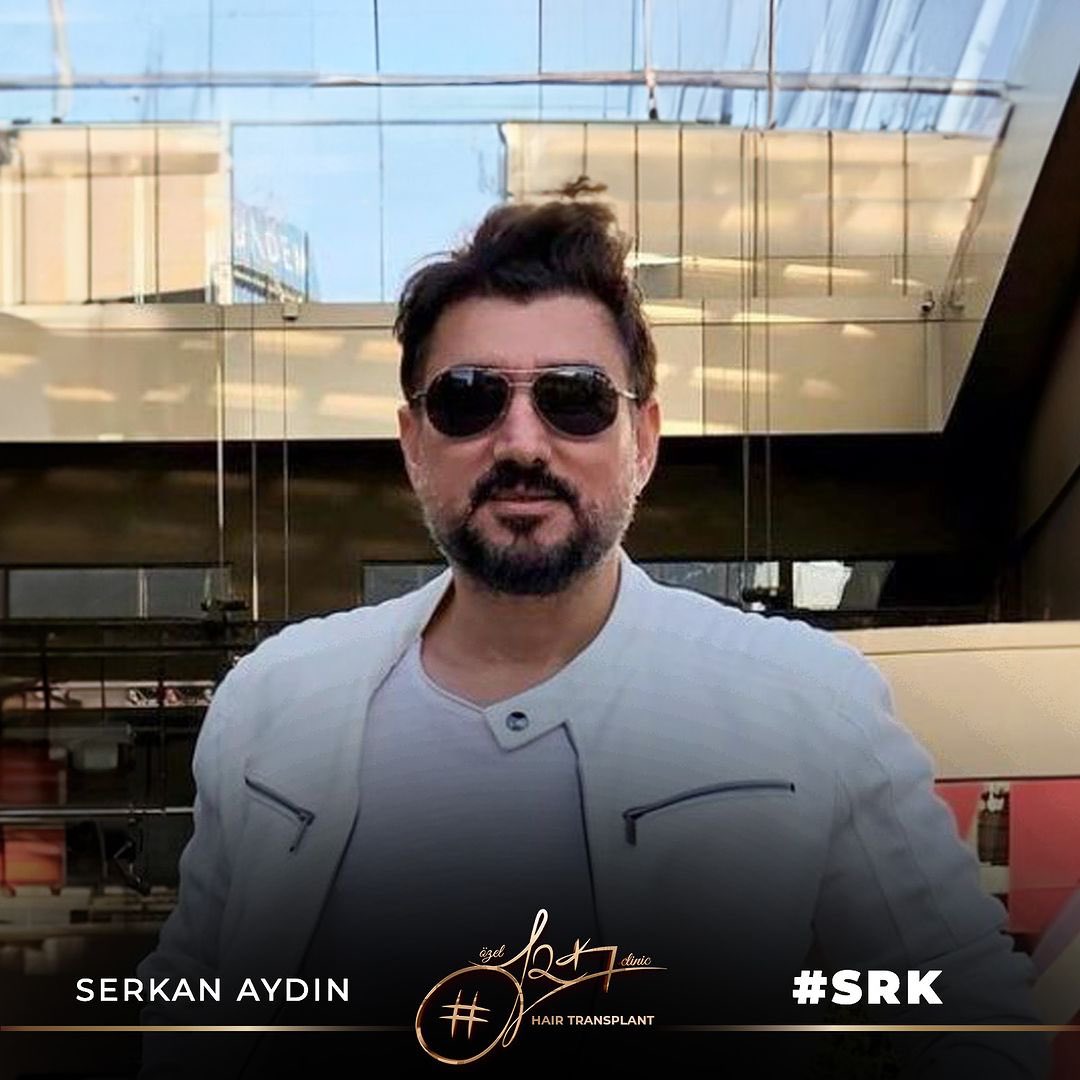 Arenamedd's tweet photo. Natural Hairline Restoration with DHI Method 🎨🧑‍🎨
#cahitkayaoglu
Contact us now for a Free Hair Analysis!

#serkanaydin #maximumgrafts #hairtransplant #beardtransplant #stemcell #haartransplant #Stammzellen #maximalgraft #maximaktransplantation #barttransplant https://t.co/yj1f51h69e
