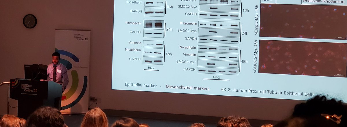 Representing our lab in the Oral Blitz session, Schrodinger Cenatus!