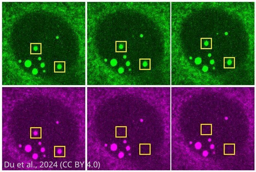 eLife's tweet photo. Clearance of protein aggregates during cell division. https://t.co/xli7u3yPGn https://t.co/utCOxNGL9c