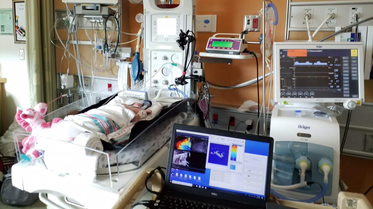 Carleton_U's tweet photo. From NICU dad to innovator, @CarletonEngDesg researcher Jim Green’s personal experience inspires his research on non-contact sensors, aiming to reduce stress and improve monitoring for the tiniest patients.👶

Read more: https://t.co/X2GnKQhSly https://t.co/XlgOke9Bjx