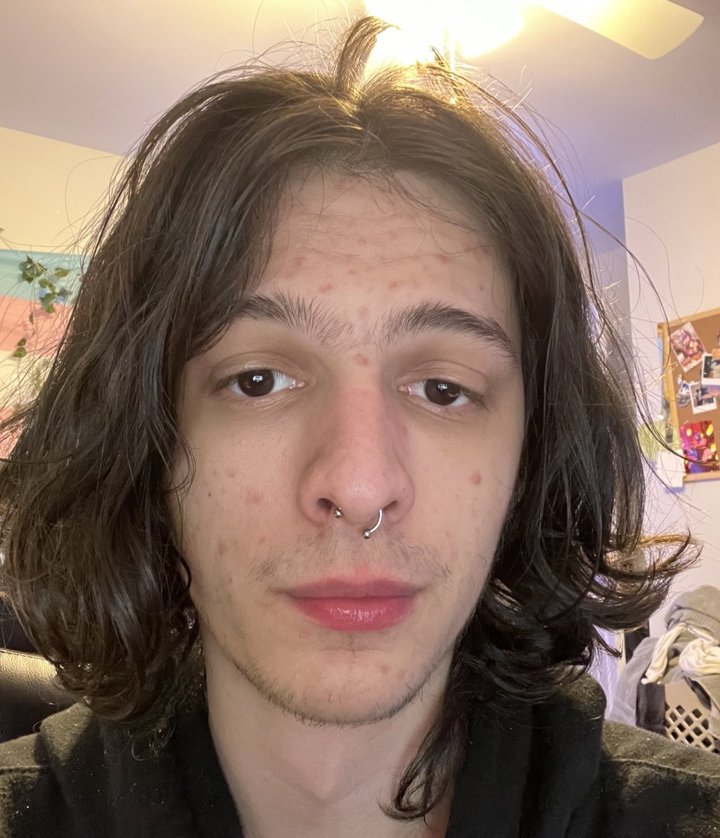bluefolf's tweet photo. It’s actually crazy what HRT can do in a year 

(June 2023)                              (June 2024) https://t.co/ZFxOV1Zcr1