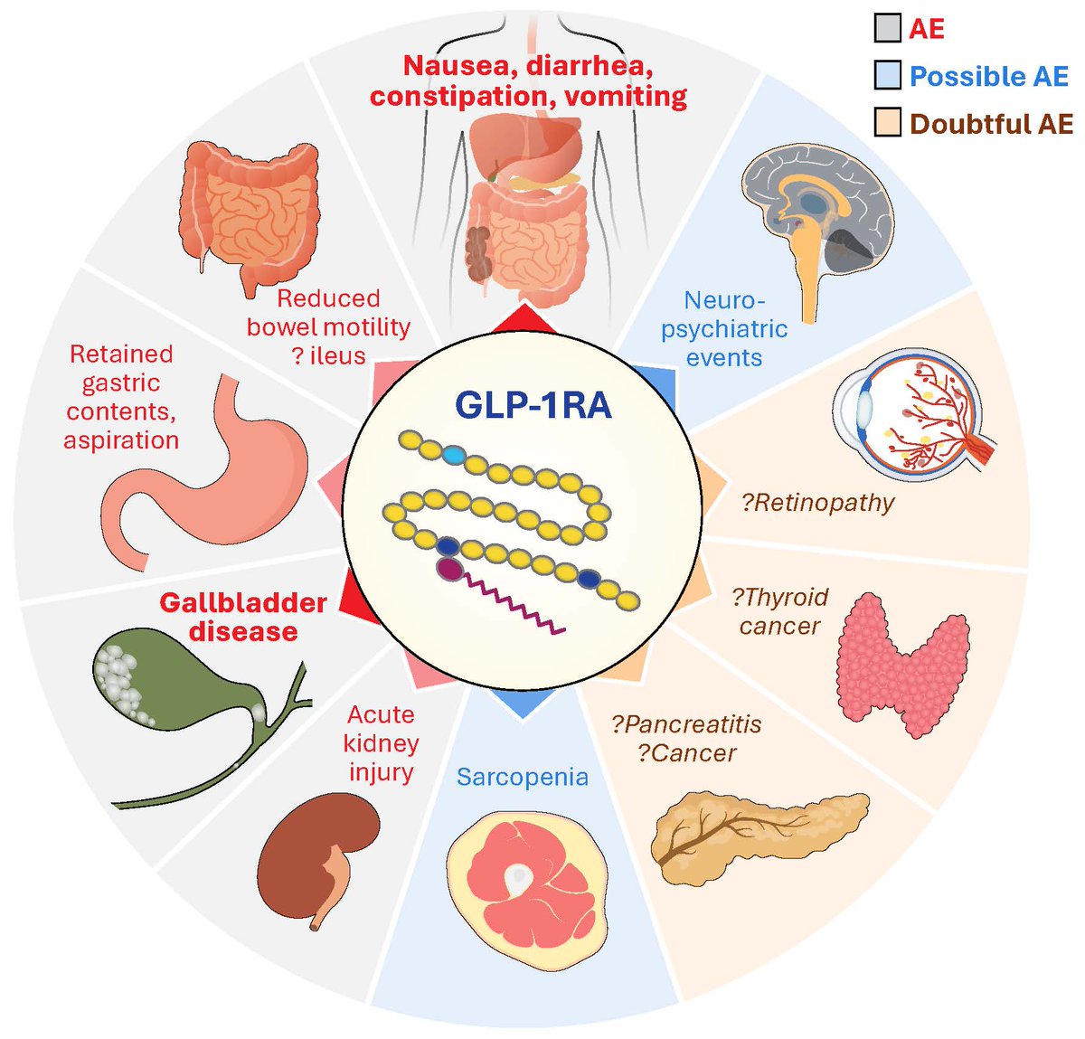 Daniel J Drucker (@danieljdrucker) on Twitter photo GLP-1 medicines produce adverse events, predominantly gastrointestinal, transient in most. Yet controversy continues surrounding what AEs are rare but real vs. alleged but not rigorously proven in RCTs or real world data. Free to read <a href="/DiabetesCareADA/">Diabetes Care, a research journal of the ADA 🌟</a> diabetesjournals.org/care/article/d… GLP-1 medicines produce adverse events, predominantly gastrointestinal, transient in most. Yet controversy continues surrounding what AEs are rare but real vs. alleged but not rigorously proven in RCTs or real world data. Free to read <a href="/DiabetesCareADA/">Diabetes Care, a research journal of the ADA 🌟</a> diabetesjournals.org/care/article/d…