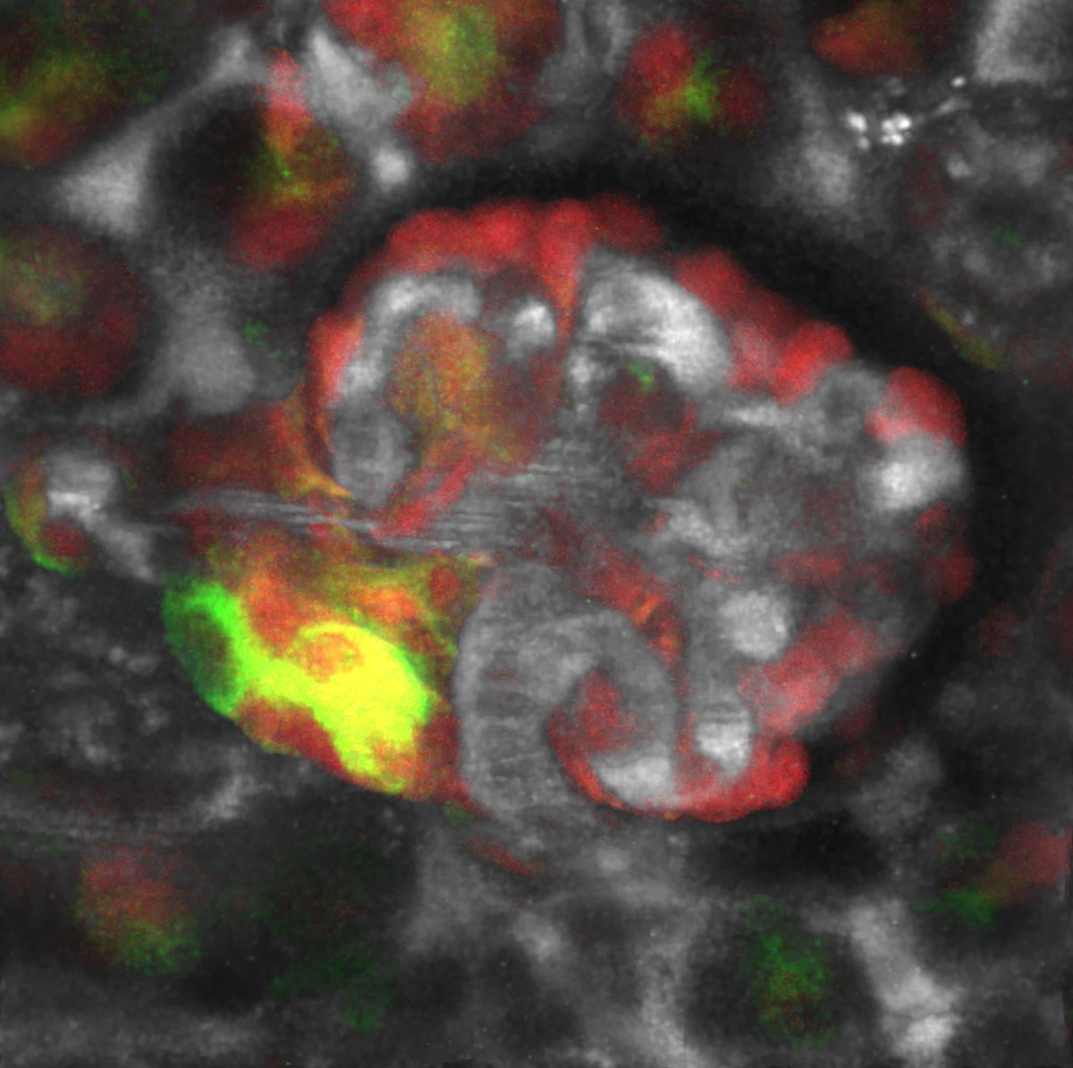 Janos Peti-Peterdi (@jpetipeterdi) on Twitter photo Big thank you to Yun Xia and Tom Coffman for the nice commentary in the <a href="/jclinicalinvest/">Journal of Clinical Investigation</a> on our paper by <a href="/gyarmatigina/">Georgina Gyarmati</a> re kidney regeneration in #CKD
jci.org/articles/view/β¦ Big thank you to Yun Xia and Tom Coffman for the nice commentary in the <a href="/jclinicalinvest/">Journal of Clinical Investigation</a> on our paper by <a href="/gyarmatigina/">Georgina Gyarmati</a> re kidney regeneration in #CKD
jci.org/articles/view/β¦