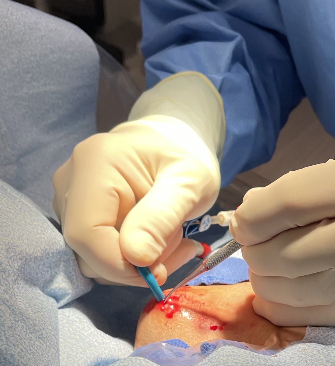 Michael Cumming tweet media